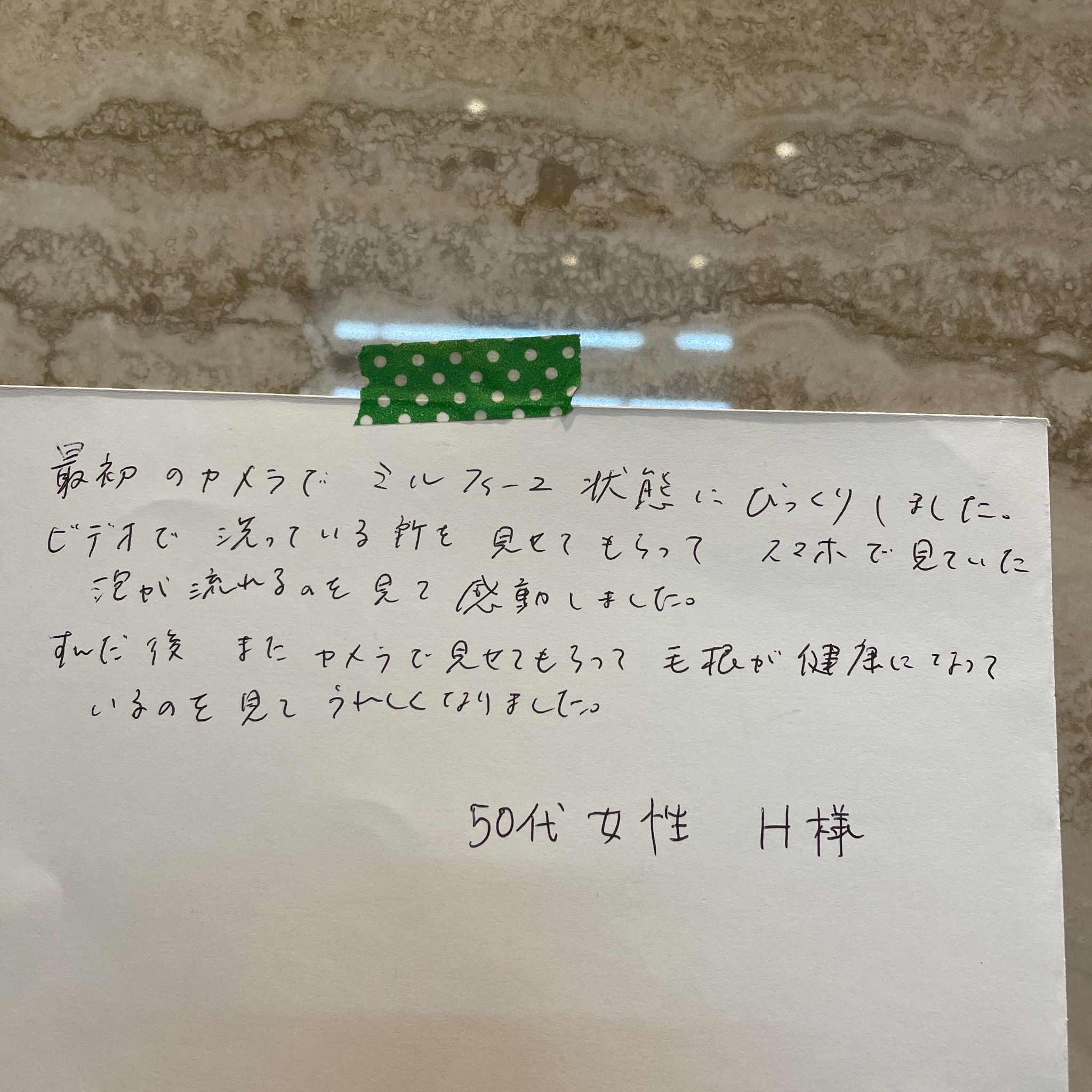 ビフォーアフターの頭皮の違いを見てうれしくなった